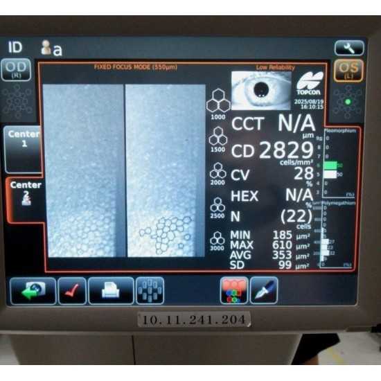Microscopio endotelial Topcon SP-1P