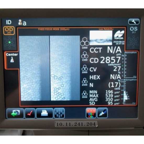 Microscopio endotelial Topcon SP-1P