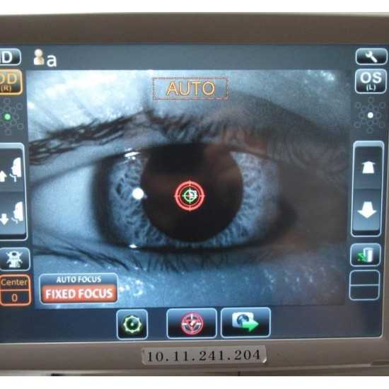 Microscopio endotelial Topcon SP-1P
