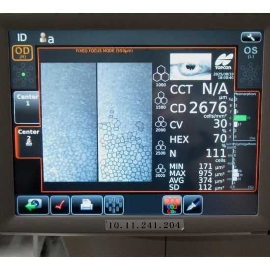 Microscopio endotelial Topcon SP-1P