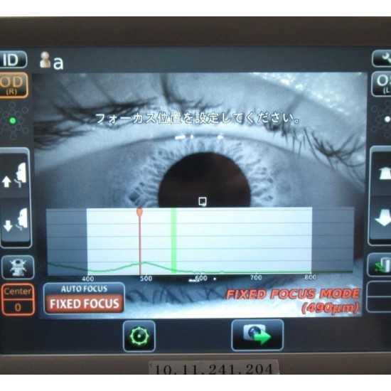 Microscopio endotelial Topcon SP-1P