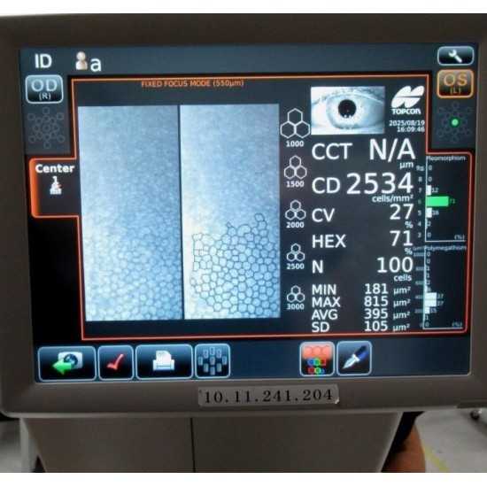 Microscopio endotelial Topcon SP-1P